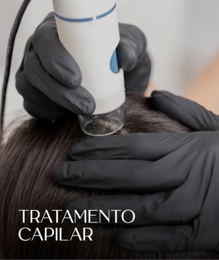 Tratamento para queda de cabelo, tricologista.